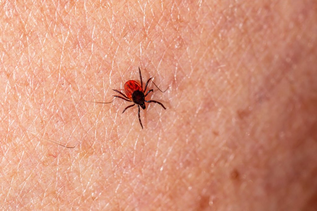tick bites